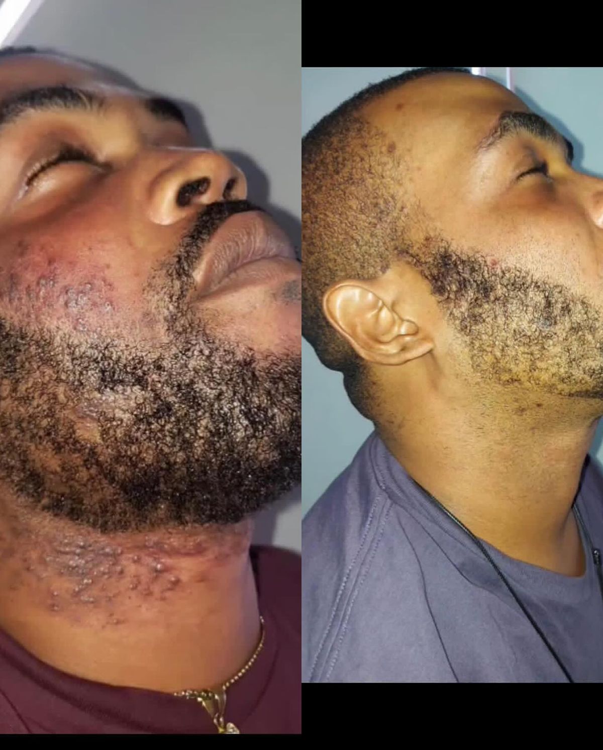 Smoothing solution™