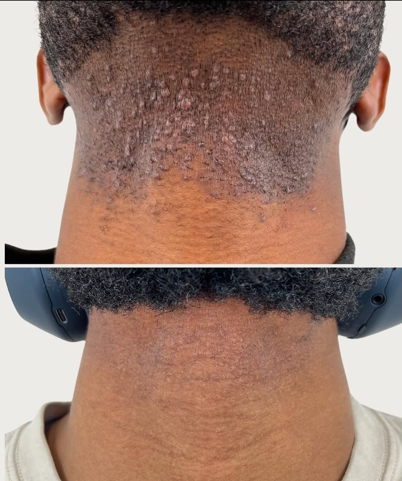 Smoothing solution™